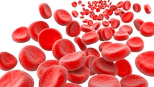 Demir Eksikliği Belirtileri ve Tedavisi Demir Eksikliği Belirtileri ve Tedavisi